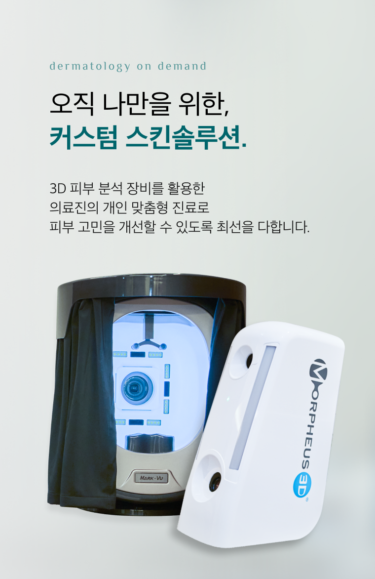 모바일